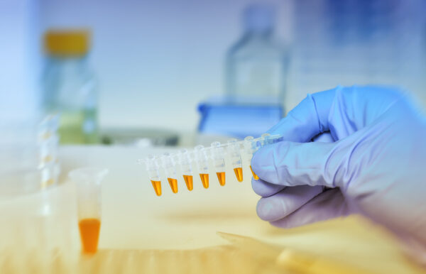 istock-671918596