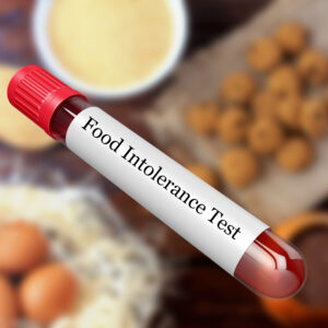 blood-sample-in-test-tube-for-food-intolerance-test-in-laboratory-1178653617_3508x2480