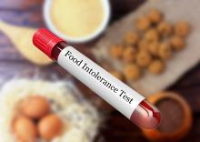 blood-sample-in-test-tube-for-food-intolerance-test-in-laboratory-1178653617_3508x2480_0